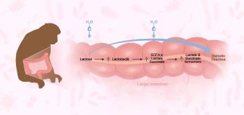 blog lactose
