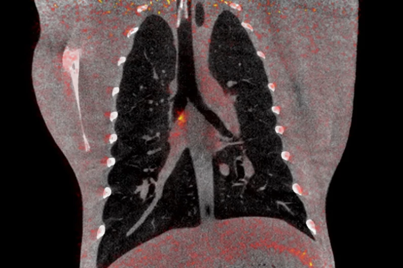 Corona vaccine research: PET-CT