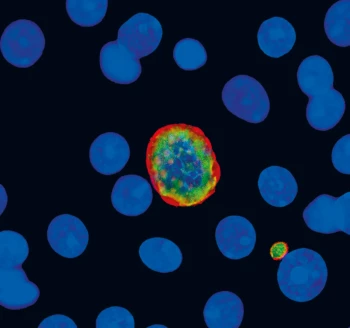 content malaria iv