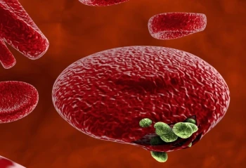 malaria